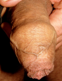 gail31