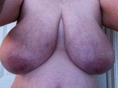 Busty Breast Reductions - Set 18