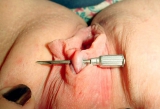 extreme pussy piercing