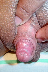 Big clit