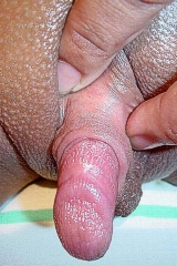 Big clit