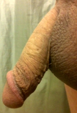 Dick pics
