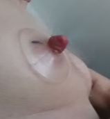 self nippel play