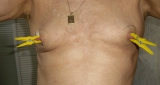 self nippel play