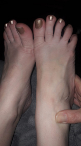 Feet fetish 2