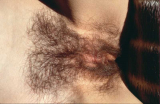 Bettina Riedel from Hannover show her pussy