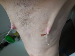 My tits in pain (nipples removed) - N