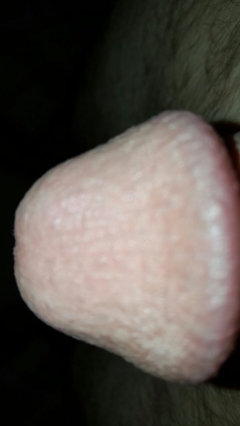 007 penis - N