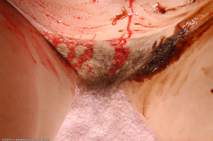 Missy Hairy mature - N