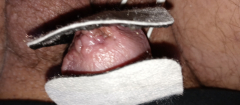 Electric shock my tiny spun penis Head inflicting pain - N