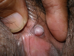 Clit Panorama - N