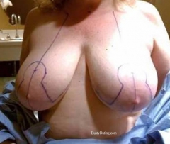 Busty Breast Reductions - Set 10 - N